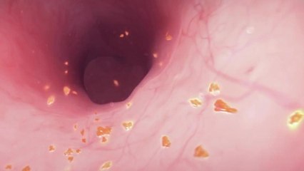 Pourquoi le ventre gargouille ?