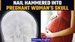 Pakistani pregnant woman had nail hammered into her skull for a boy |Oneindia News