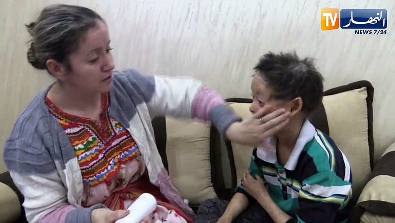 تيزي وزو: حسين رمضاني.. طفل في التاسعة من العمر يعاني من مرض "السمك الجلدي"