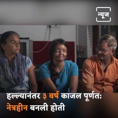 After Losing One Eye To Acid Attack, Gujarat Girl Now Aspires To Crack Civil Services Exam