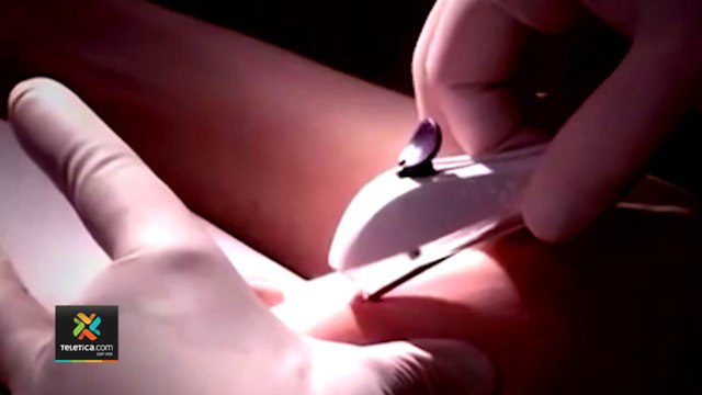 tn7-Acceso-a-implante-anticonceptivo-redujo-embarazos-adolescentes,-según-datos-de-la-CCSS-11022