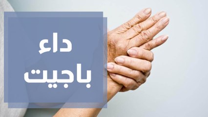أسباب وأعراض داء باجيت في العظام