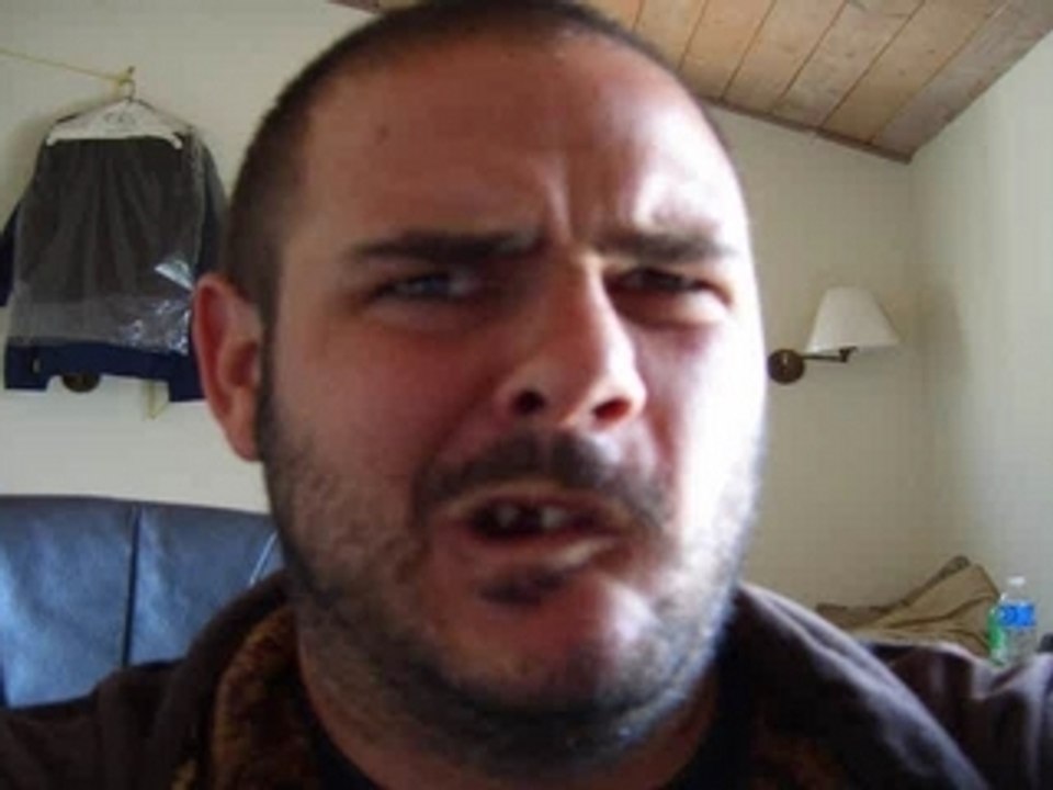 Real Ugly Tootless Guy Going Nuts