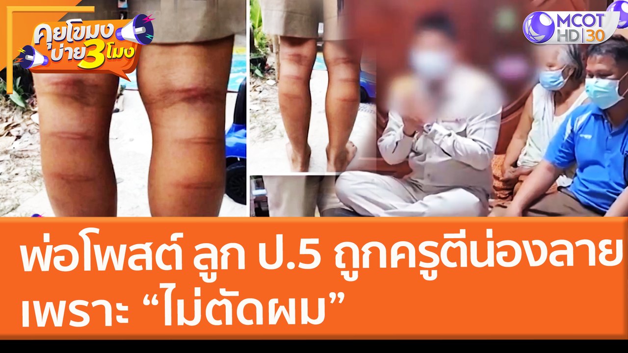 พ่อโพสต์ ลูก ป.5 ถูกครูตีน่องลาย เพราะ 'ไม่ตัดผม"  (15 ก.พ. 65) คุยโขมงบ่าย 3 โมง