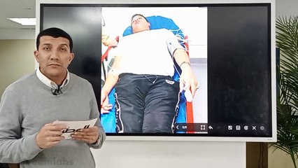 طبيب يكشف أعراض مرض الكرونز المصاب به حمو بيكا.. وحقيقة حقنة الـ 130 ألف جنيه كل أسبوع