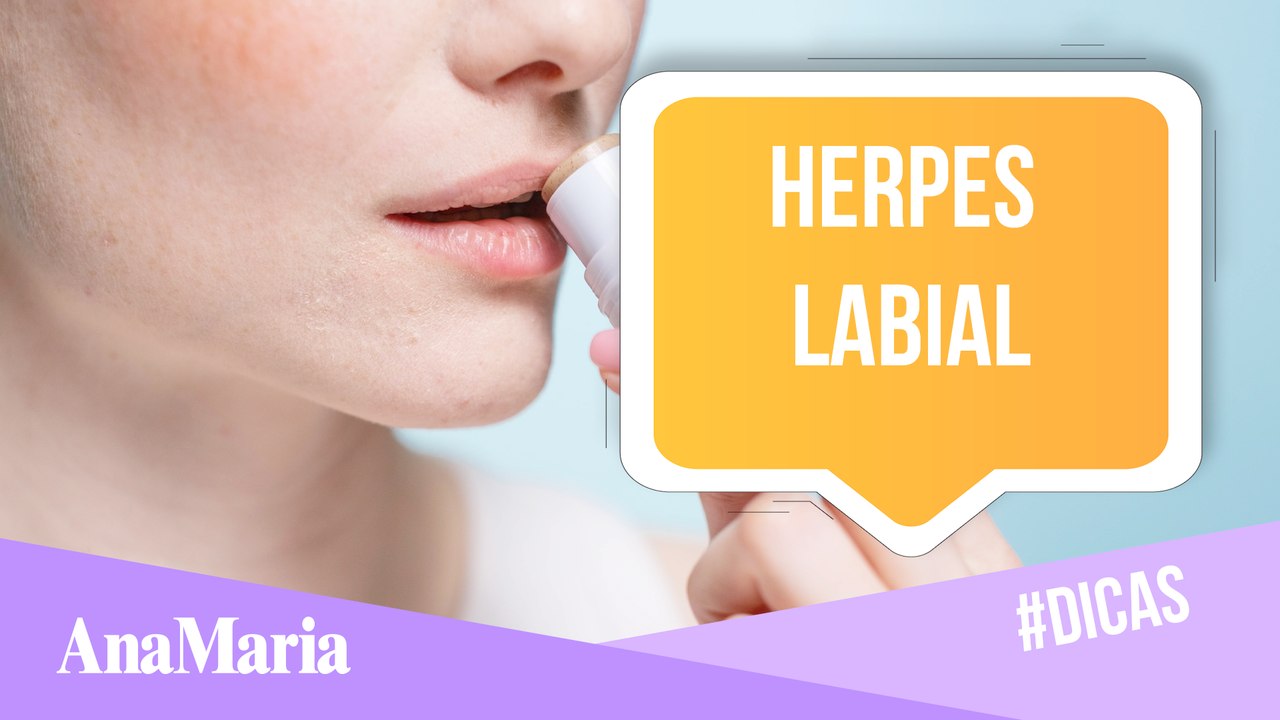 HERPES LABIAL: SAIBA MAIS SOBRE A DOENÇA QUE DEU O QUE FALAR NO BBB22 (2022)