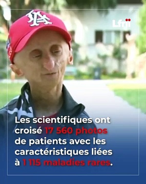Et si la reconnaissance faciale permettait de détecter les maladies rares ?