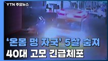 '온몸에 멍 자국' 5살 아동 숨져...40대 고모 긴급체포 / YTN
