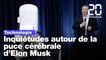 Neuralink : Les scientifiques s'inquiètent du projet de puce cérébrale d’Elon Musk