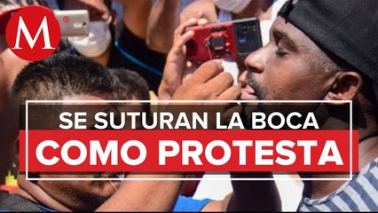 En Chiapas, migrantes se cosen la boca como protesta; INM reprueba autolesiones
