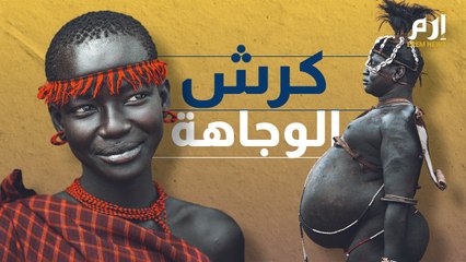 كرش الرجل يزيده جاذبية !!