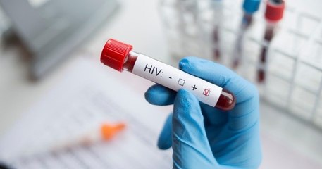 VIH : pour la première fois dans le monde, une femme séropositive guérit grâce à un traitement médical