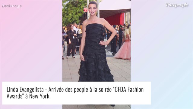 Linda Evangelista défigurée par la chirurgie : elle se montre enfin en photos, témoignage bouleversant