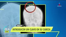 Clavan clavo en cabeza de una embarazada para que tenga un varón