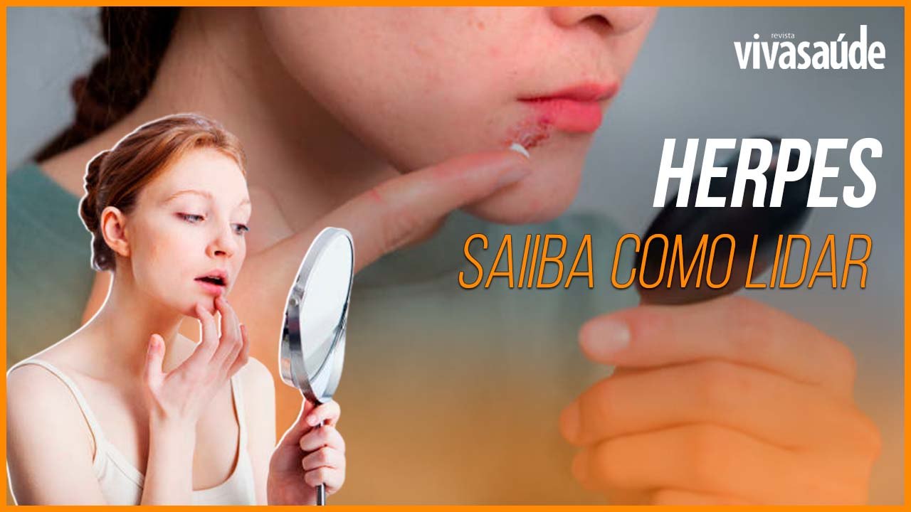 HERPES: O QUE É? COMO É O TRATAMENTO? ALIÁS, QUAL A FORMA DE CONTÁGIO?