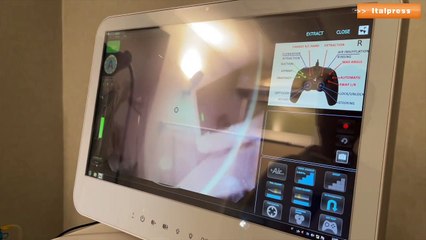 Palermo, clinica Candela prima al Sud a dotarsi del colonscopio robotico