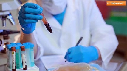 Nuova tecnica per identificare SARS-CoV-2 nei tamponi