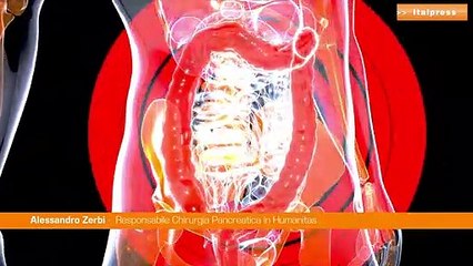 Passi avanti per un modello artificiale di pancreas