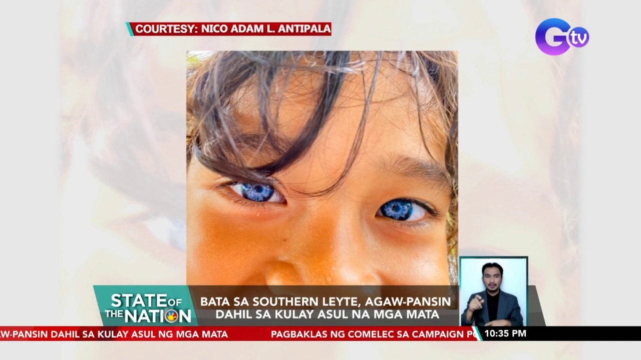 Bata sa Southern Leyte, agaw-pansin dahil sa kulay asul na mga mata | SONA