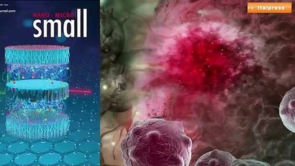 Un nanosistema per contrastare il tumore al colon