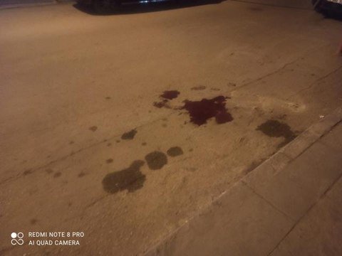 Son dakika haberleri! Silahlı saldırı sonucu bir vatandaş iki bacağından birden vuruldu