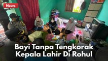 Bayi Tanpa Tempurung Kepala Lahir Di Lubuk Bendahara, Polres Rohul Beri Bantuan !!
