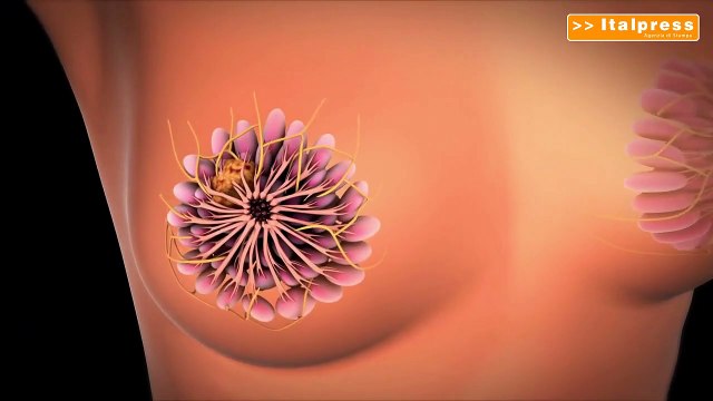 Tumore seno, in menopausa fino a 7-8 anni terapia anti-ormonale