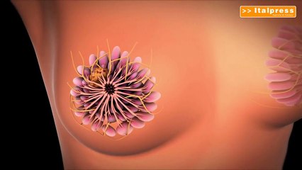 Tumore seno, in menopausa fino a 7-8 anni terapia anti-ormonale