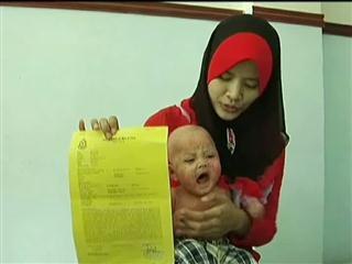 Kulit bayi tujuh bulan mengelupas dan berdarah selepas keluar hospital