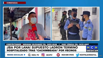 ¡Tras macaneada! En Comayagua, asaltante “iba por lana” y terminó hospitalizado