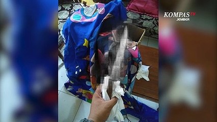 Istri Potong Alat Kelamin Suami dengan Pisau saat Berhubungan Badan