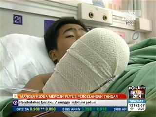 Putus tangan akibat mercun