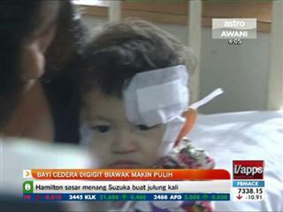 Bayi cedera digigit biawak makin pulih