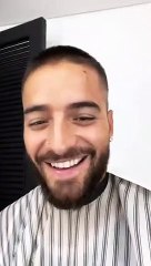 Maluma muestra las heridas en su rostro luego de que lo mordiera su perro.