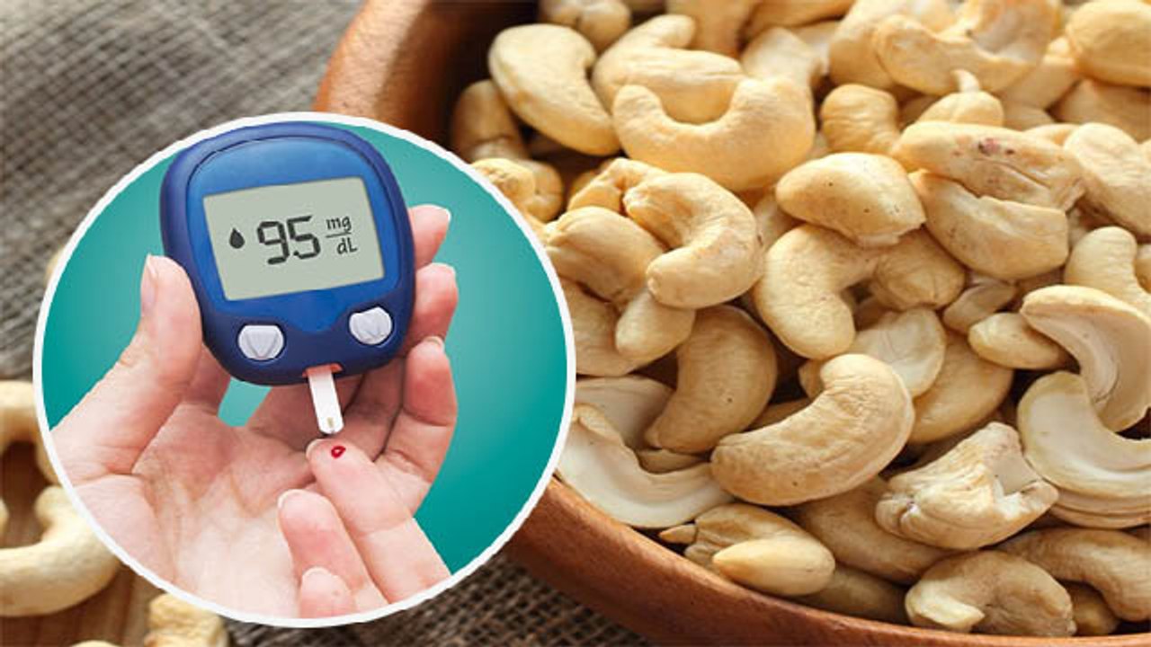 Diabetes Patients के लिए Cashews खाने के जबरदस्त फायदे, जाने क्या है खाने का सही तरीका | Boldsky