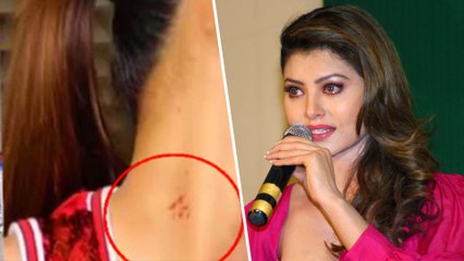 Urvashi Rautela's Angry Reaction On News Report Regarding Her Alleged 'Love Bite'