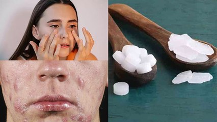 कपूर लगाने से खुजली से लेकर फटी एड़ियों तक से छुटकारा, कैसे करें इस्तेमाल | Boldsky