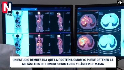 Científicos españoles crean un fármaco que frena la metástasis en cáncer de mama