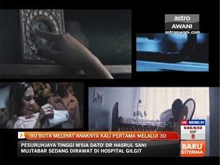 Ibu buta melihat anaknya kali pertama melalui 3D