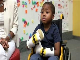 First child double hand transplant announced in US
