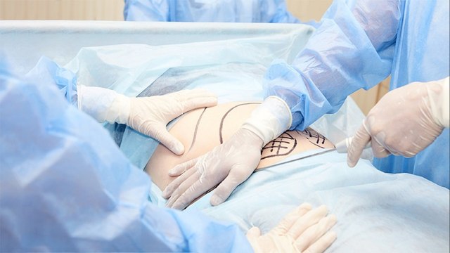 bd-procedimientos-esteticos-220222