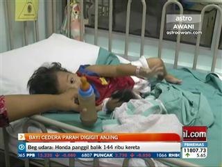 Bayi cedera parah digigit anjing