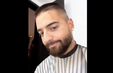 Así le ha quedado la cara a Maluma tras ser atacado por su dóberman