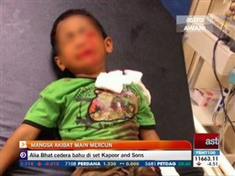 Mangsa akibat main mercun