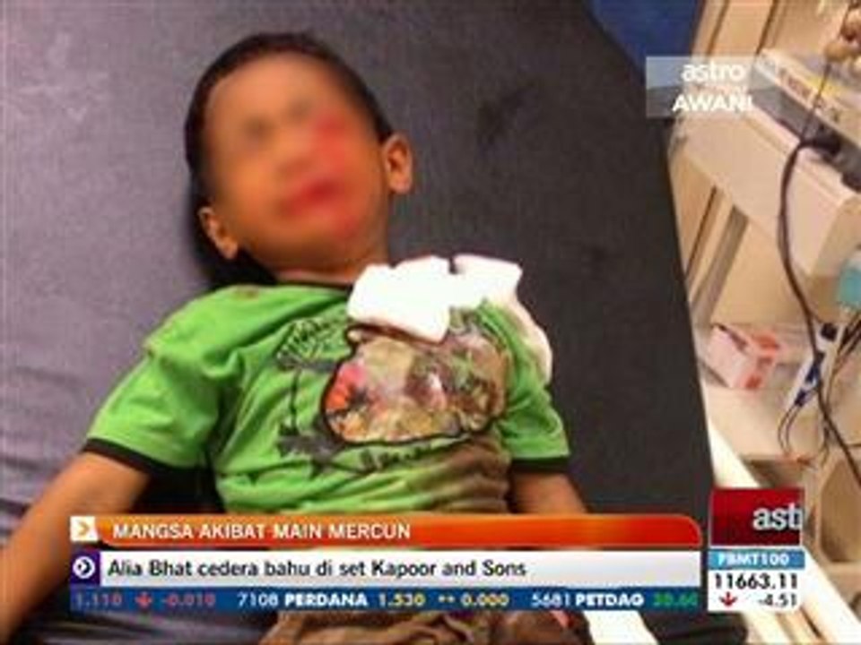 Mangsa akibat main mercun
