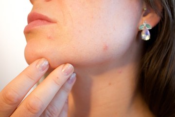 8 - Top 5 de los mejores componentes para tener una piel sana