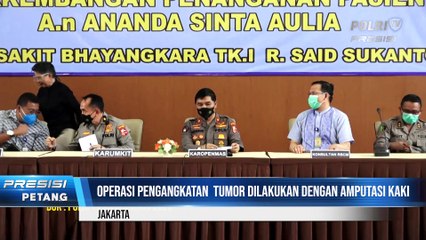 Operasi Berjalan Lancar, Sinta akan Menjalani Kemoterapi