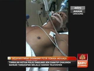 Nelayan parah disambar petir semasa menjala