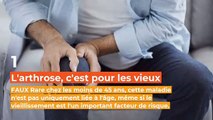 5 idées fausses sur l'arthrose