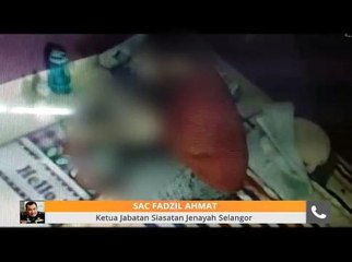 Kes dera: Polis sedang kesan wanita berusia 31 tahun bantu siasatan